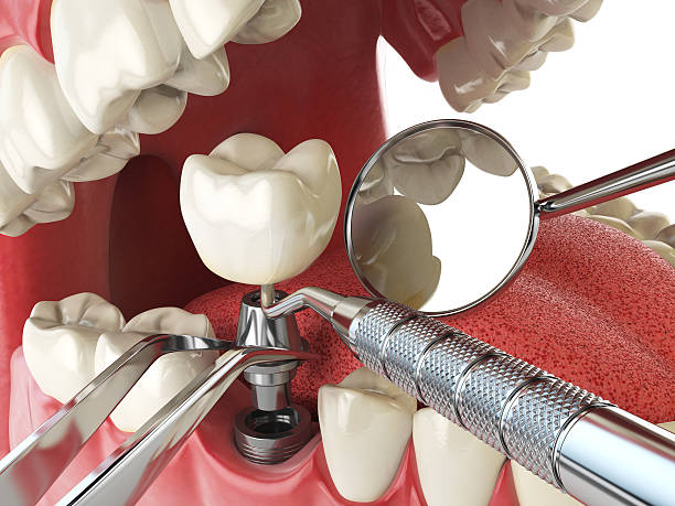 Best Emergency Gum Treatment in Jerome, IL